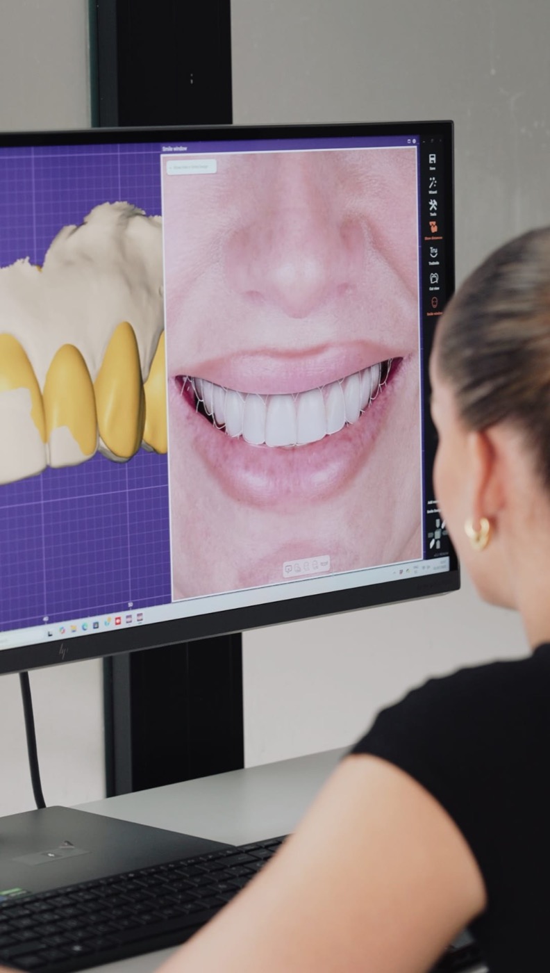 Digital smile design preview