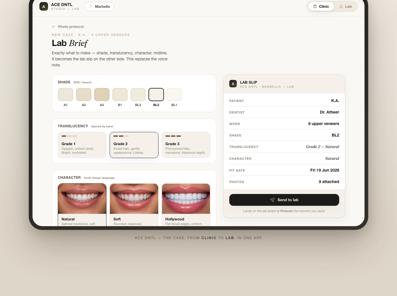 The lab brief inside the ACE DNTL app — shade, translucency and character selectors building a structured lab slip with photos attached